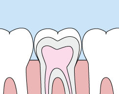An animated image of sealants done by cosmetic dentistry office Kozica Dental in Worcester, MA